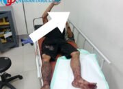 Gresik Berdarah: Warga Hulaan Dibacok OTK, Kapolsek Menganti Tabuh Genderang Perang Lawan Premanisme