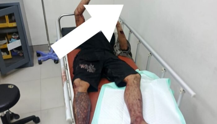 Gresik Berdarah: Warga Hulaan Dibacok OTK, Kapolsek Menganti Tabuh Genderang Perang Lawan Premanisme